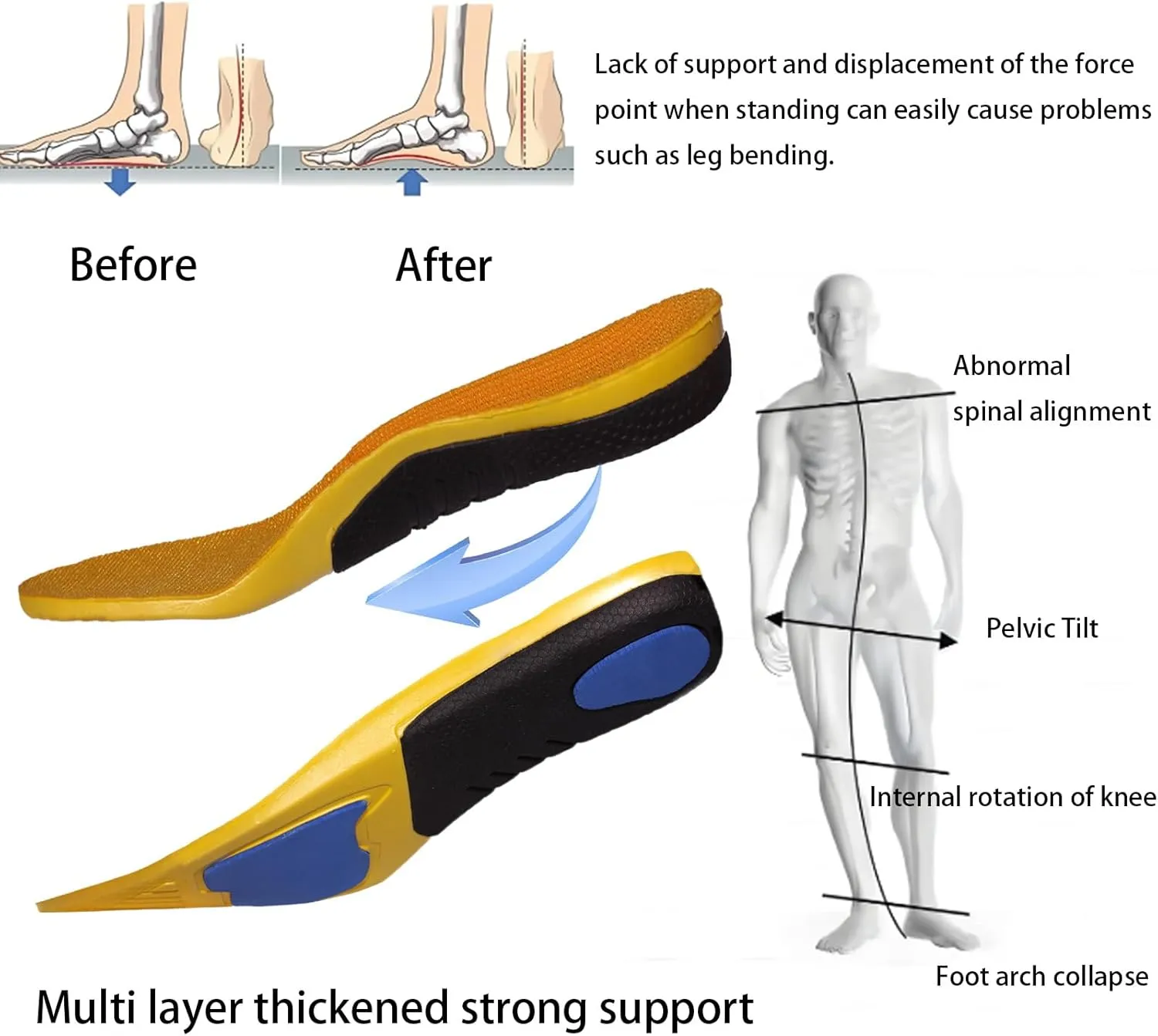 Plantar Fasciitis Relief Insoles,250 lbs High Arch Support Inserts with Comfort Cushion for Pain Relief Absorb Shock,Insoles for Arch Support Men Work Boots,Trim-to-Fit Shoe Inserts(US M 7.5-M10.5)